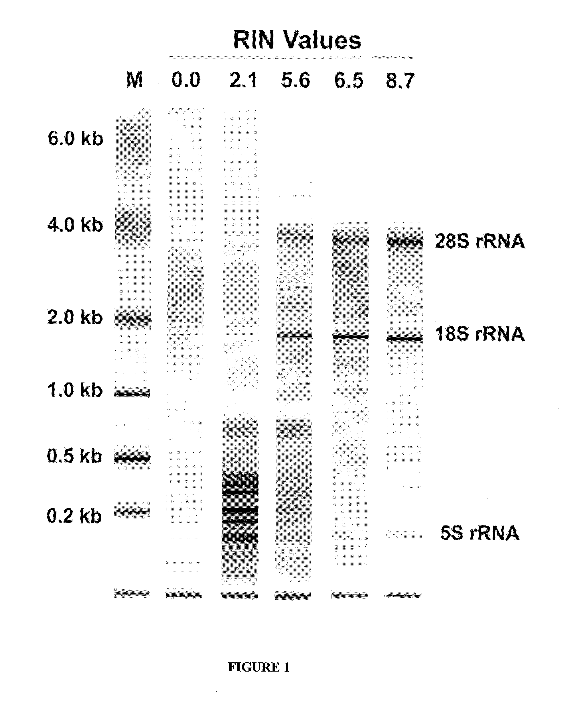Method of using tumour RNA integrity to measure response to chemotherapy in cancer patients