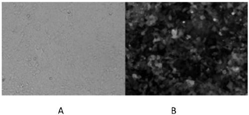 Immortalized alpha-1,3-galactosyltransferase gene knockout porcine hepatocyte line and preparation method and application thereof