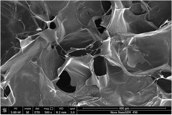 Preparation method of abalone shell powder/ZnO composite material doped intelligent hydrogel wound dressing with bacteriostatic effect