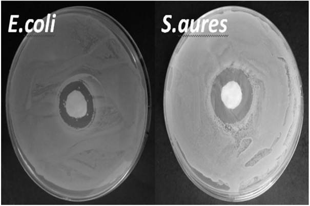 Preparation method of abalone shell powder/ZnO composite material doped intelligent hydrogel wound dressing with bacteriostatic effect