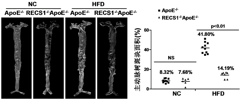 The function and application of blood shear stress response protein 1 in the treatment of atherosclerosis
