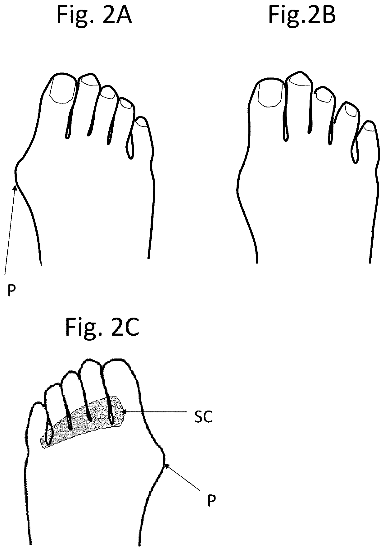 Pad for preventing foot deformity and shoe including same