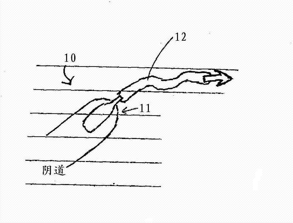Systems, implants, tools, and methods for treatments of pelvic conditions