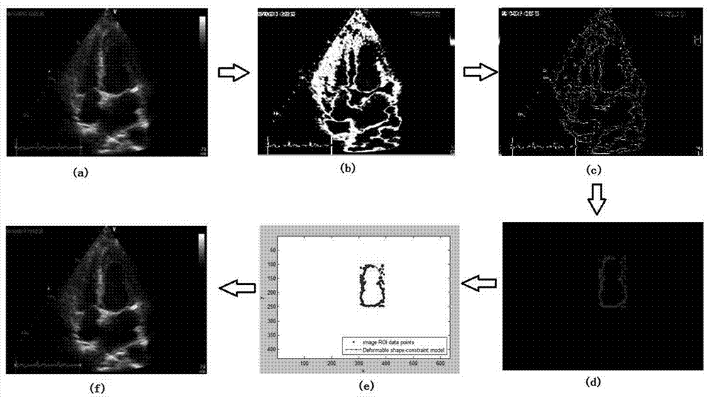 Ultrasonic kinetocardiogram segmentation algorithm