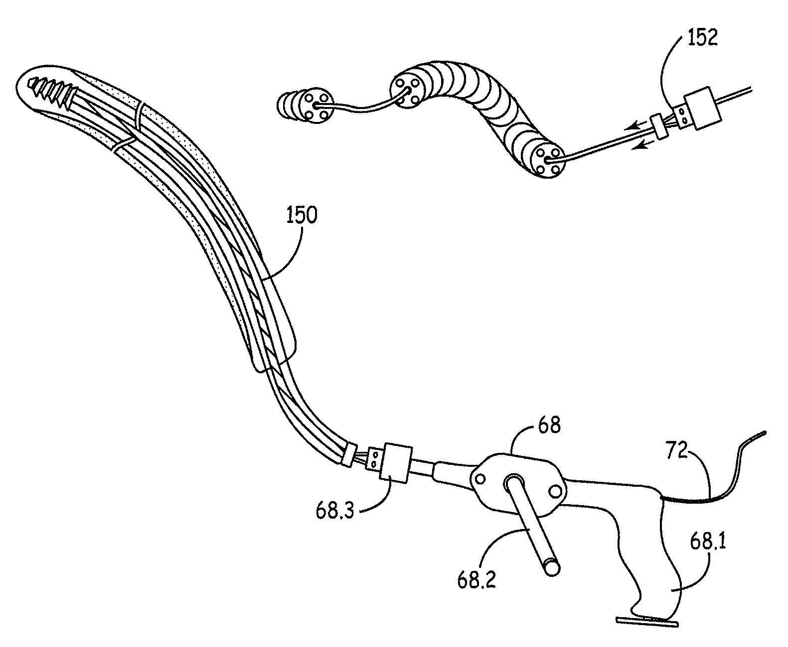 Internal cord fixation device
