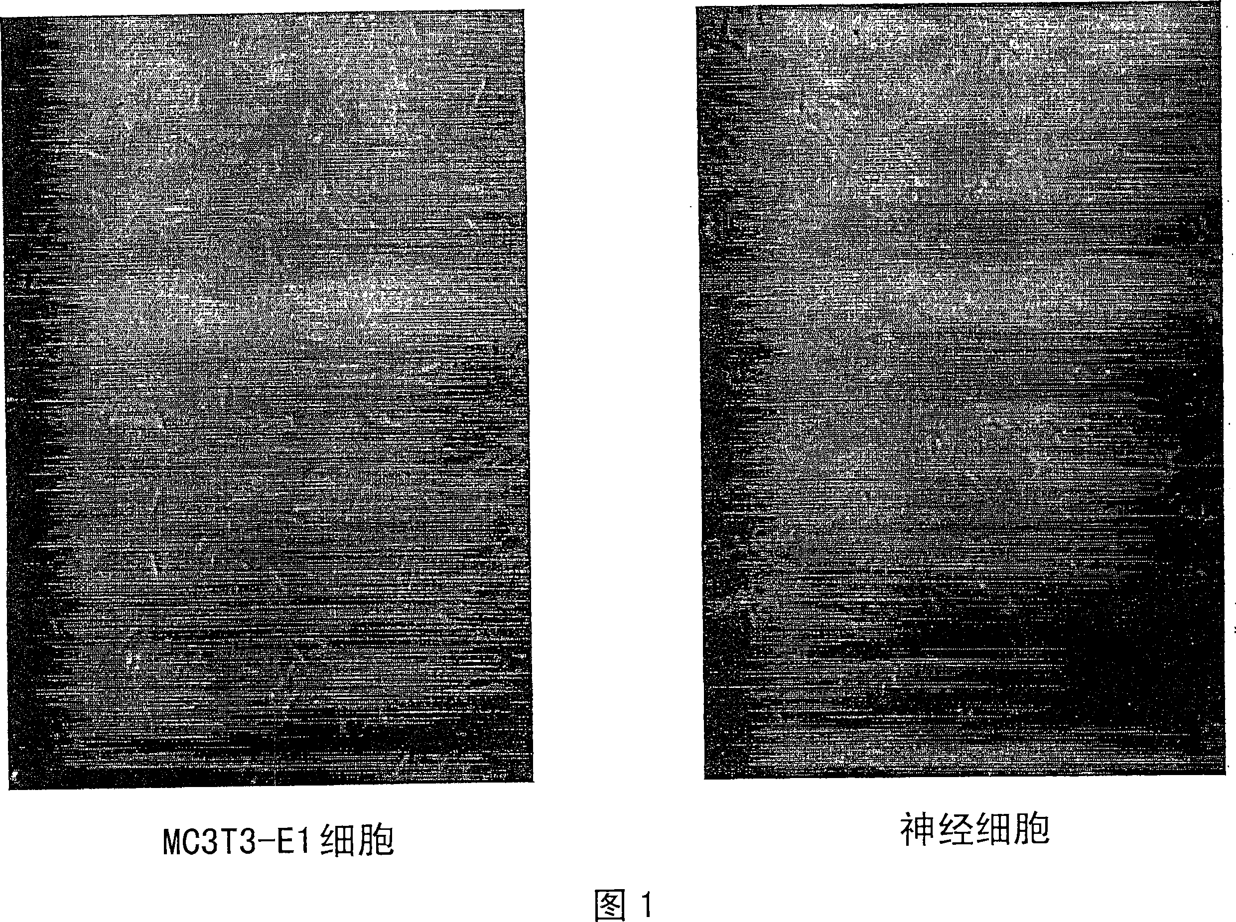 Method of cell transdifferentiation