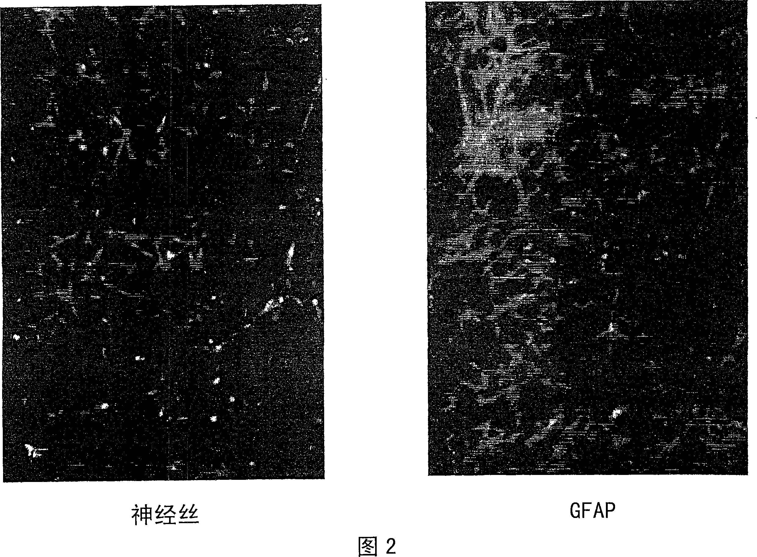 Method of cell transdifferentiation