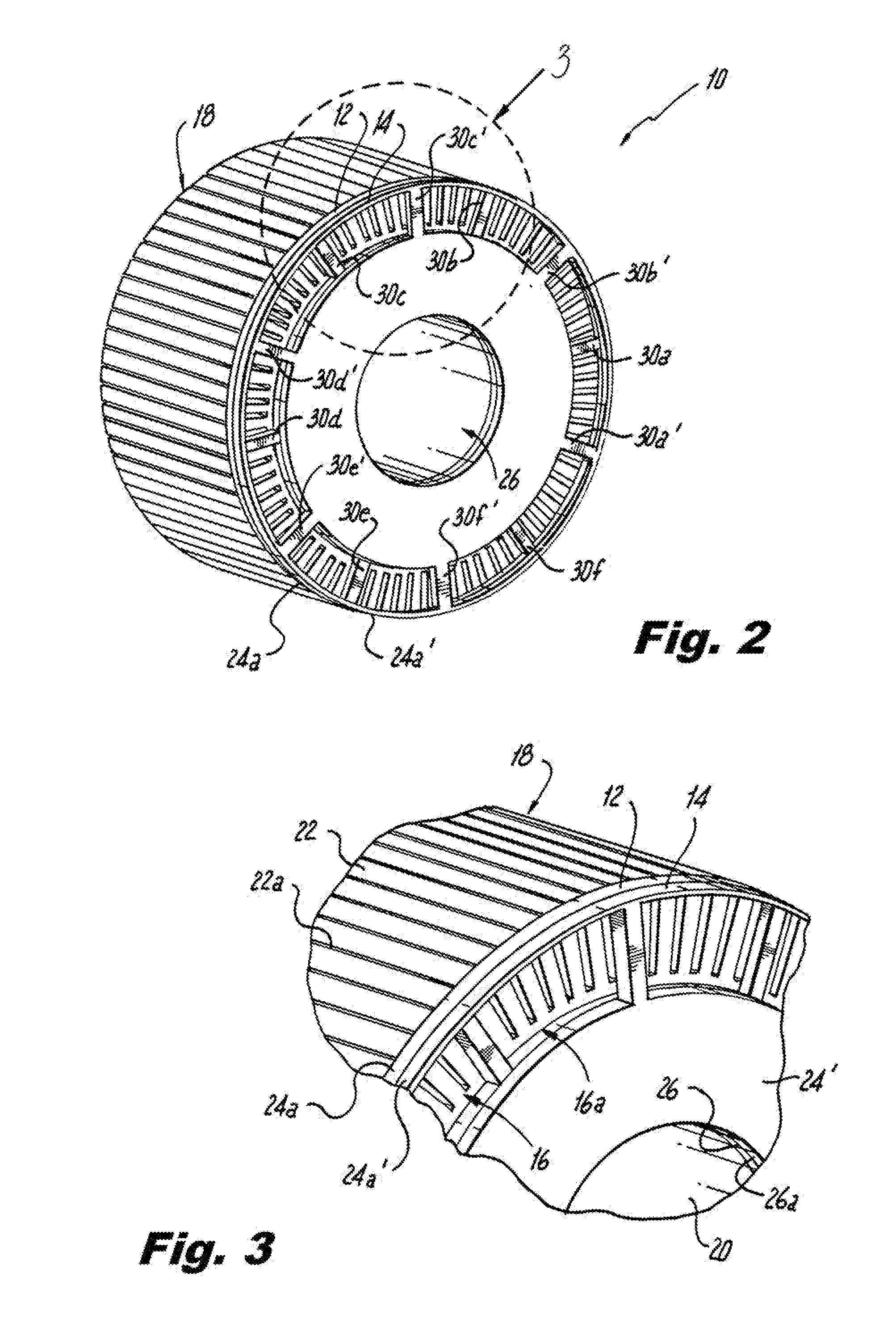 Die Cast Rotor With Steel End Rings to Contain Aluminum