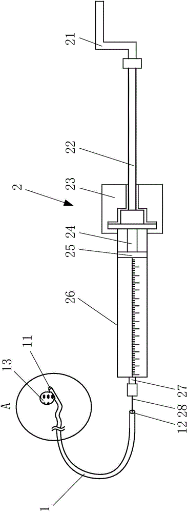 Novel blocking type calculus removing catheter