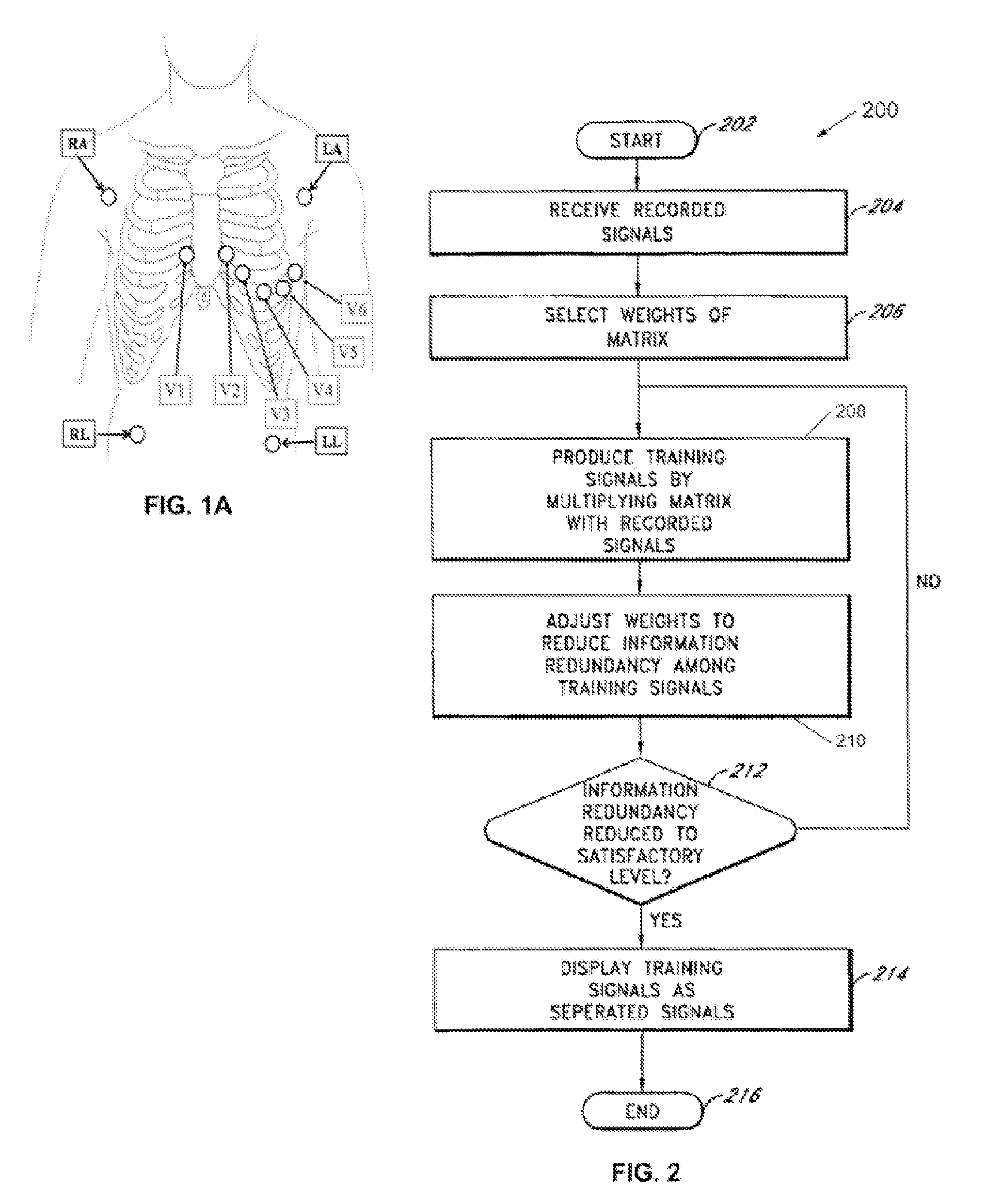 Device and method for detecting cardiac impairments
