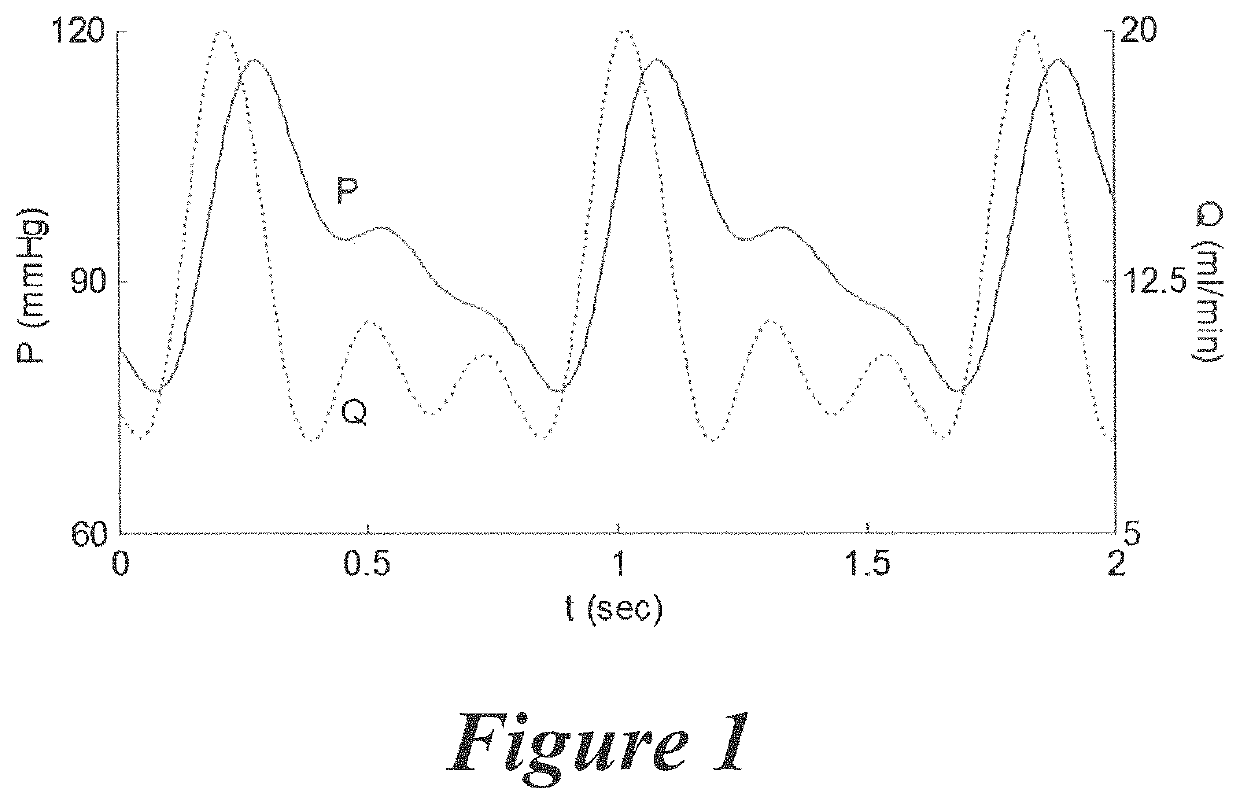 Pulsatile perfusion bioreactor for mimicking, controlling, and optimizing blood vessel mechanics