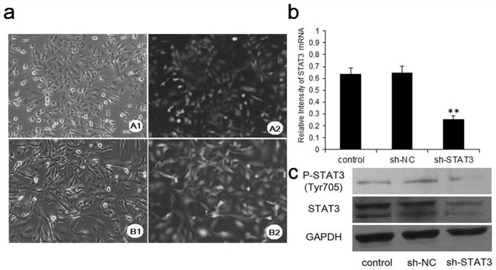 Method for researching influence of targeted silence STAT3 on hypoxia induction of human brain glioma U251 cells and application of targeted silence STAT3