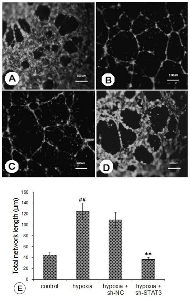 Method for researching influence of targeted silence STAT3 on hypoxia induction of human brain glioma U251 cells and application of targeted silence STAT3