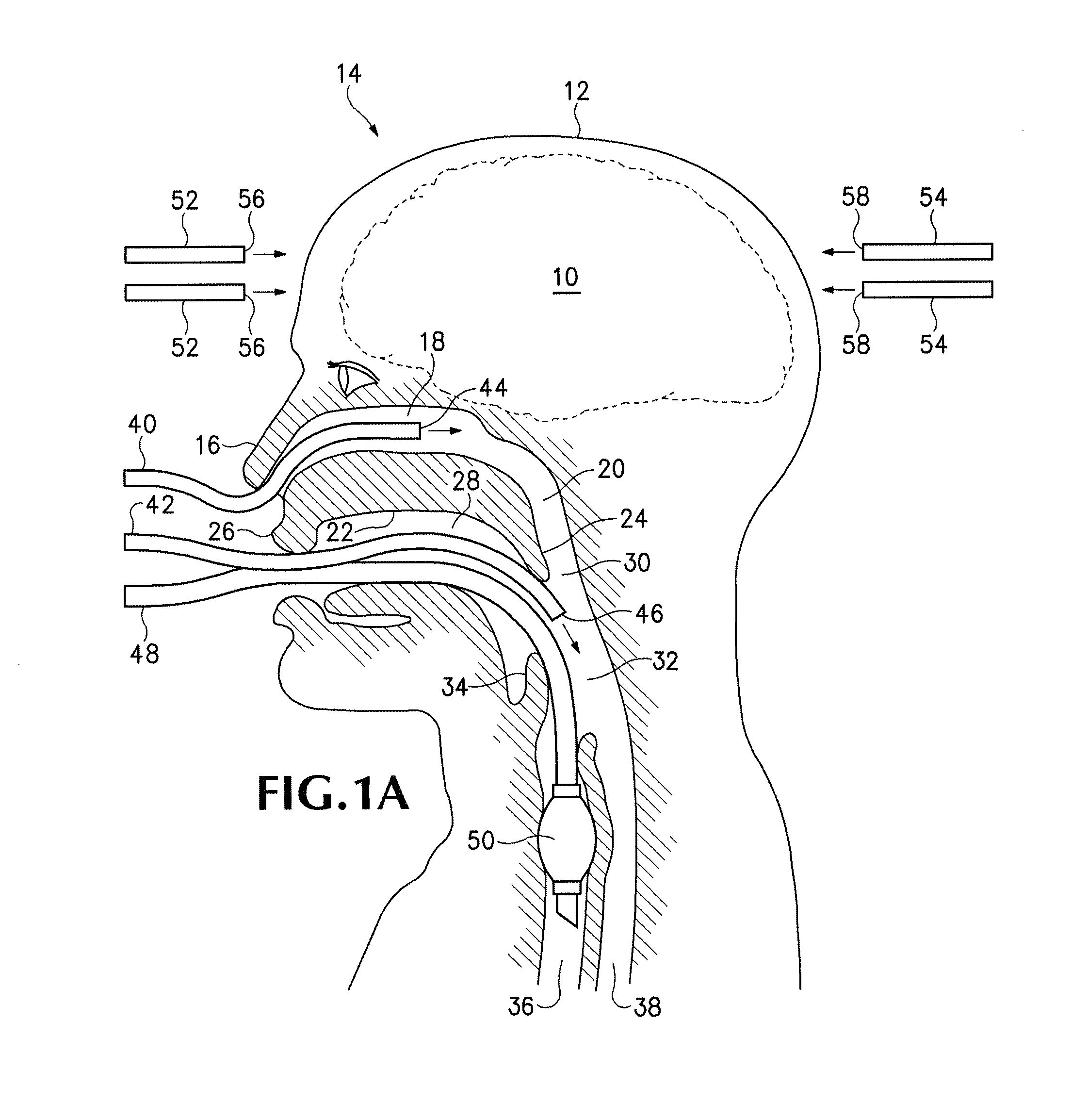 Non-invasive systems, devices, and methods for selective brain cooling