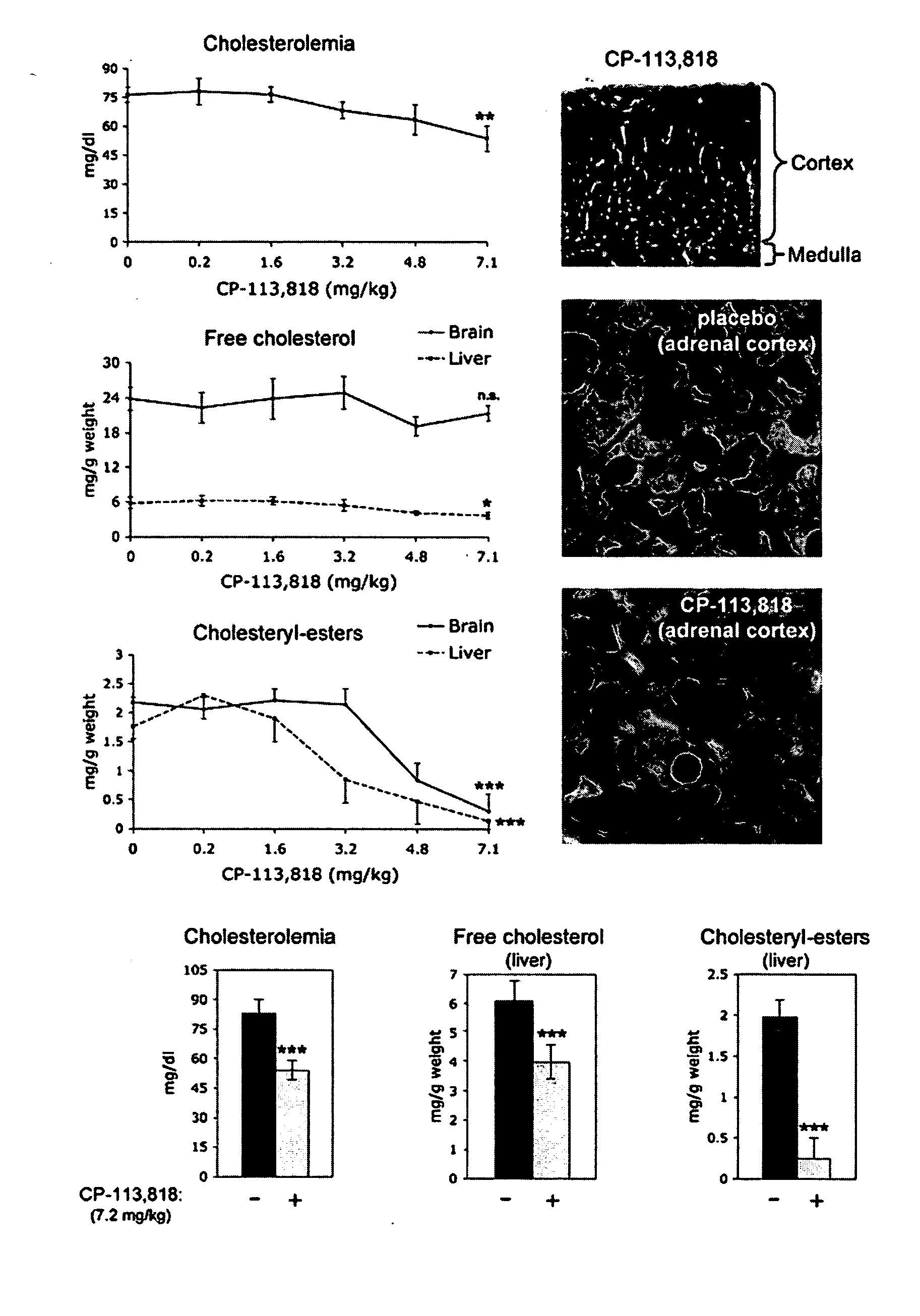 Methods for treating ACAT-related diseases