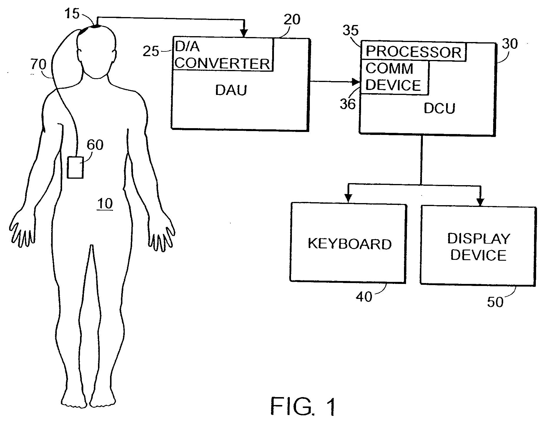 System and method of prediction of response to neurological treatment using the electroencephalogram