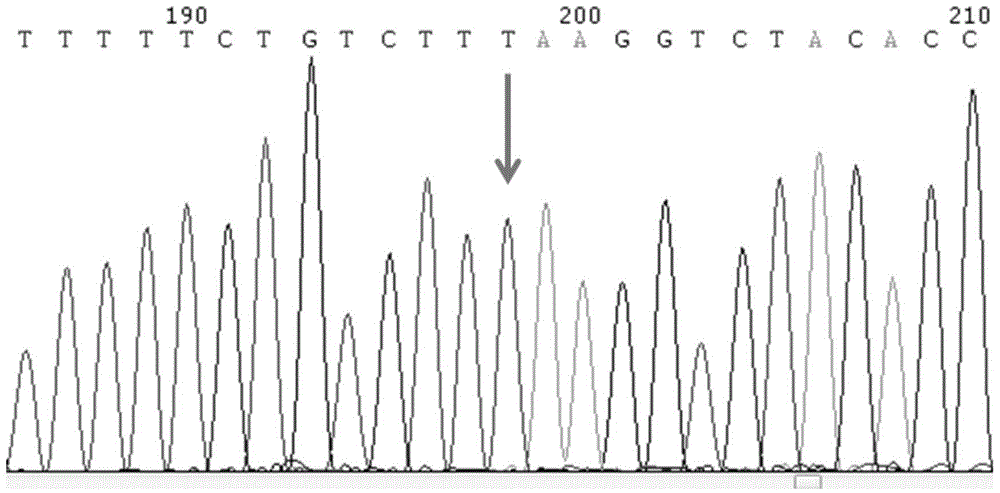 SNP molecular marker of RANTES gene related to generation of preterm birth and kit for detecting RANTES gene