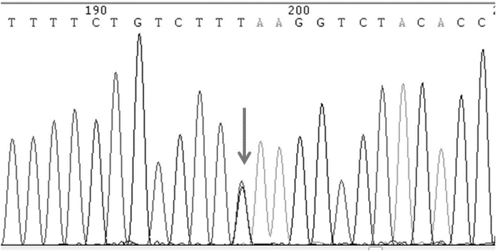 SNP molecular marker of RANTES gene related to generation of preterm birth and kit for detecting RANTES gene