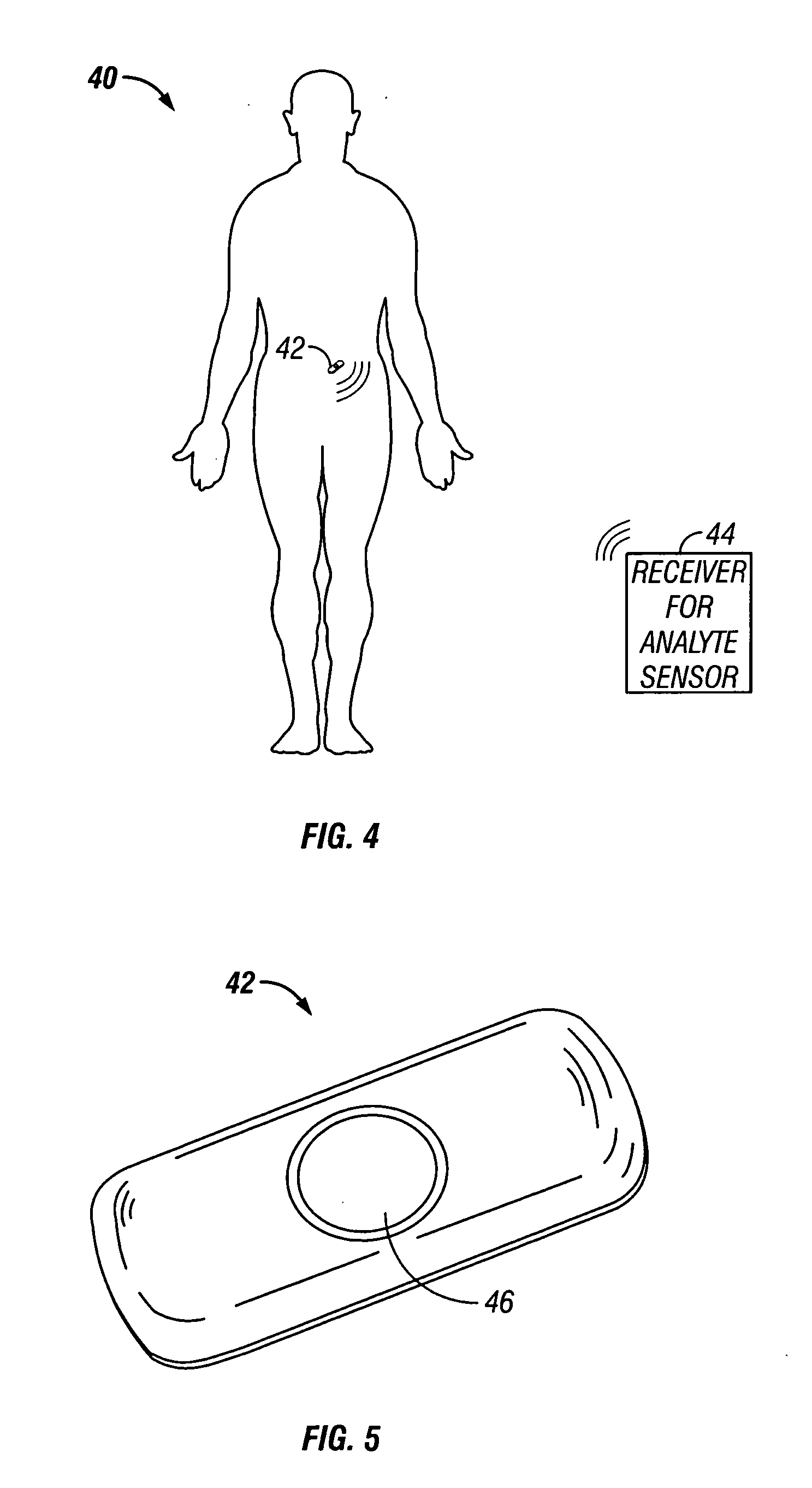 Implantable device with improved radio frequency capabilities