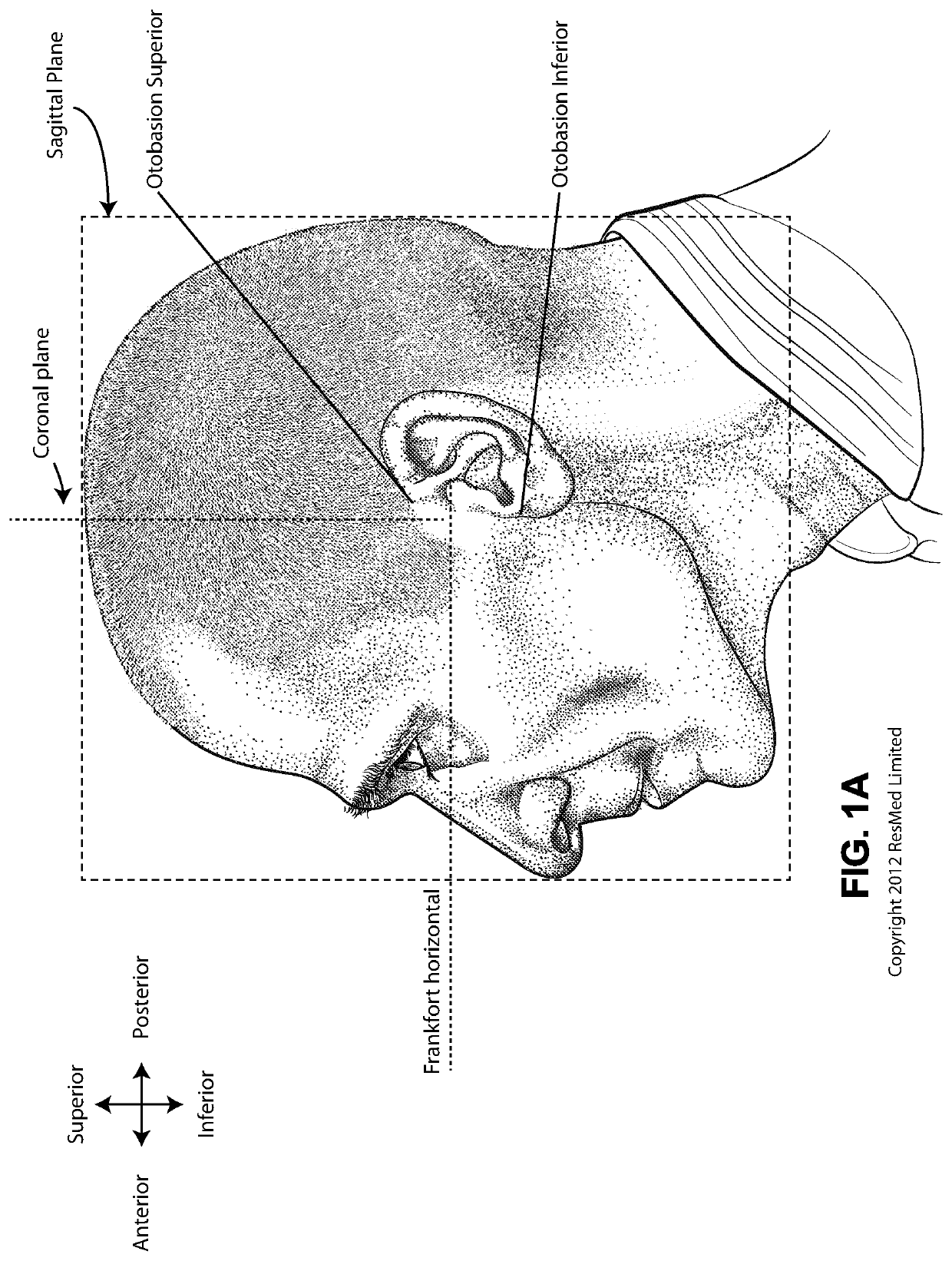 Positioning and stabilising structure and system incorporating same