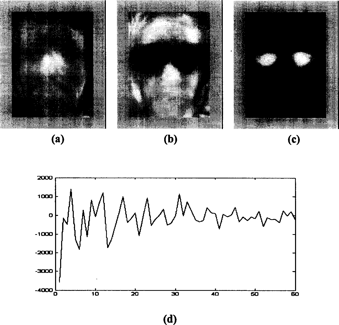 Infrared human face spectacle disturbance elimination method based on regional characteristic element compensation