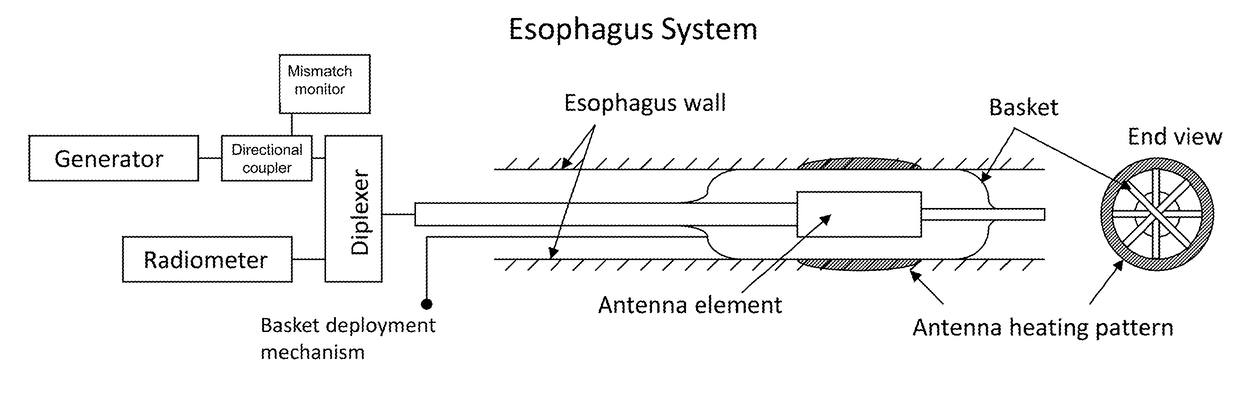 System and method for treatment of barrett's esophagus incorporating radiometric sensing