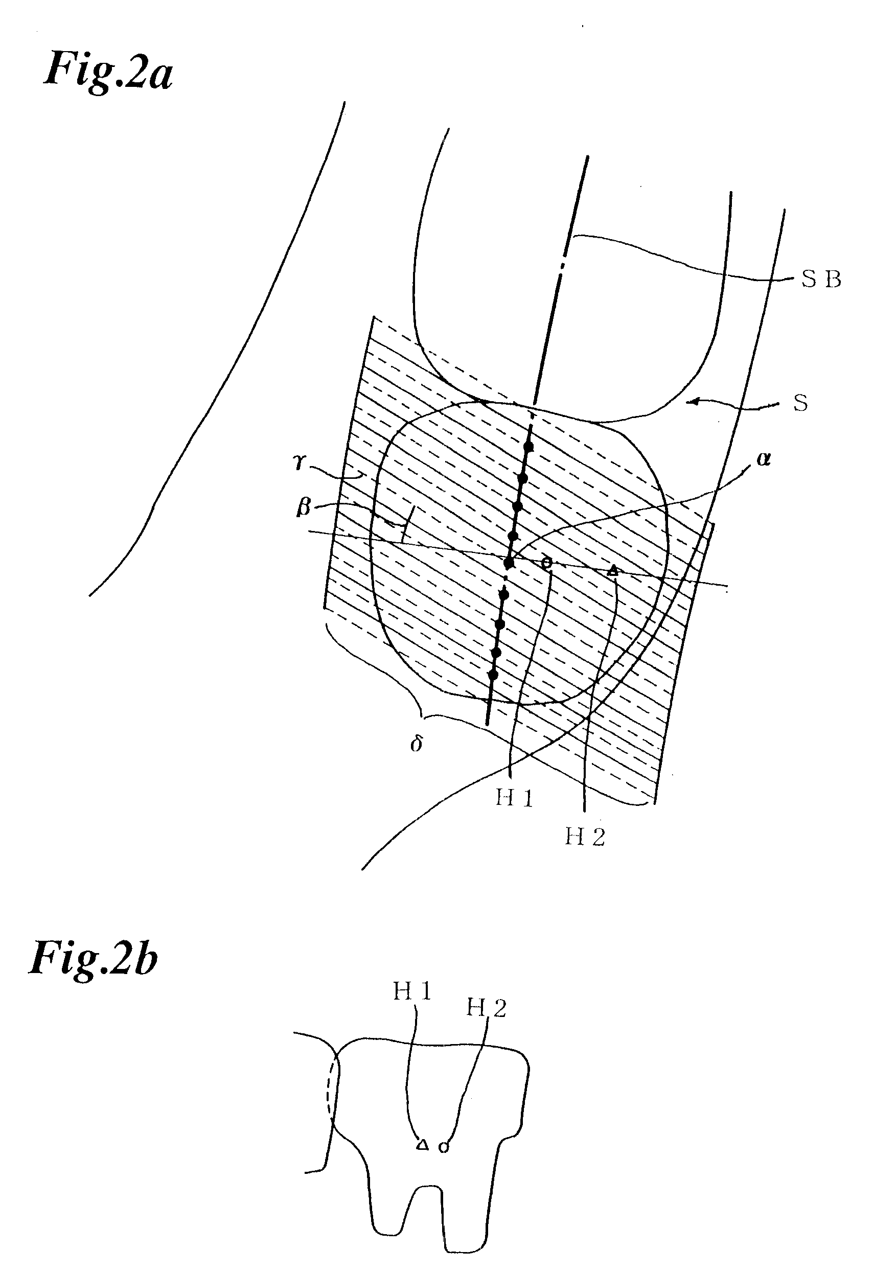 X-ray computed tomography method and apparatus
