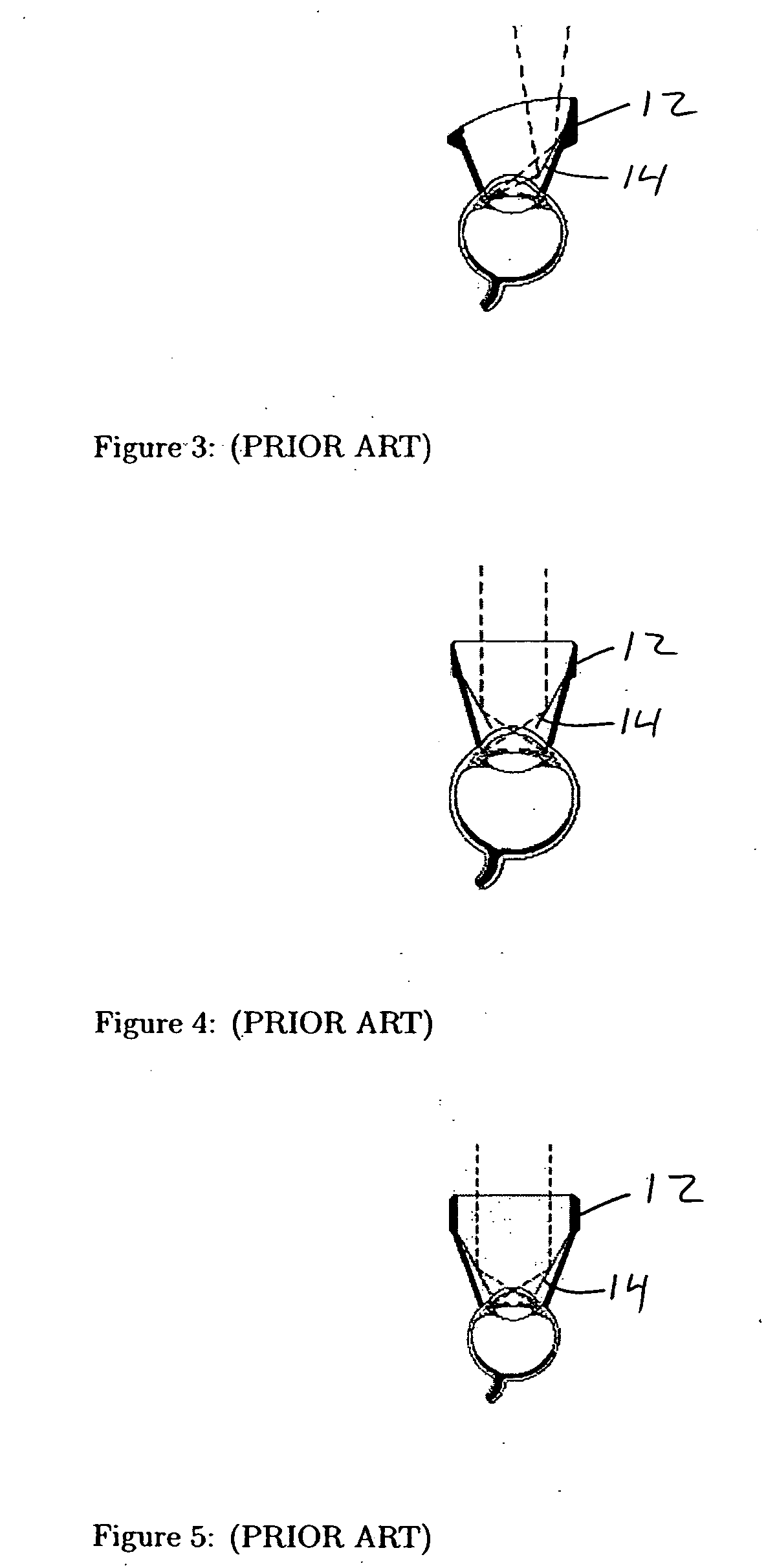 Method and device for optical ophthalmic therapy