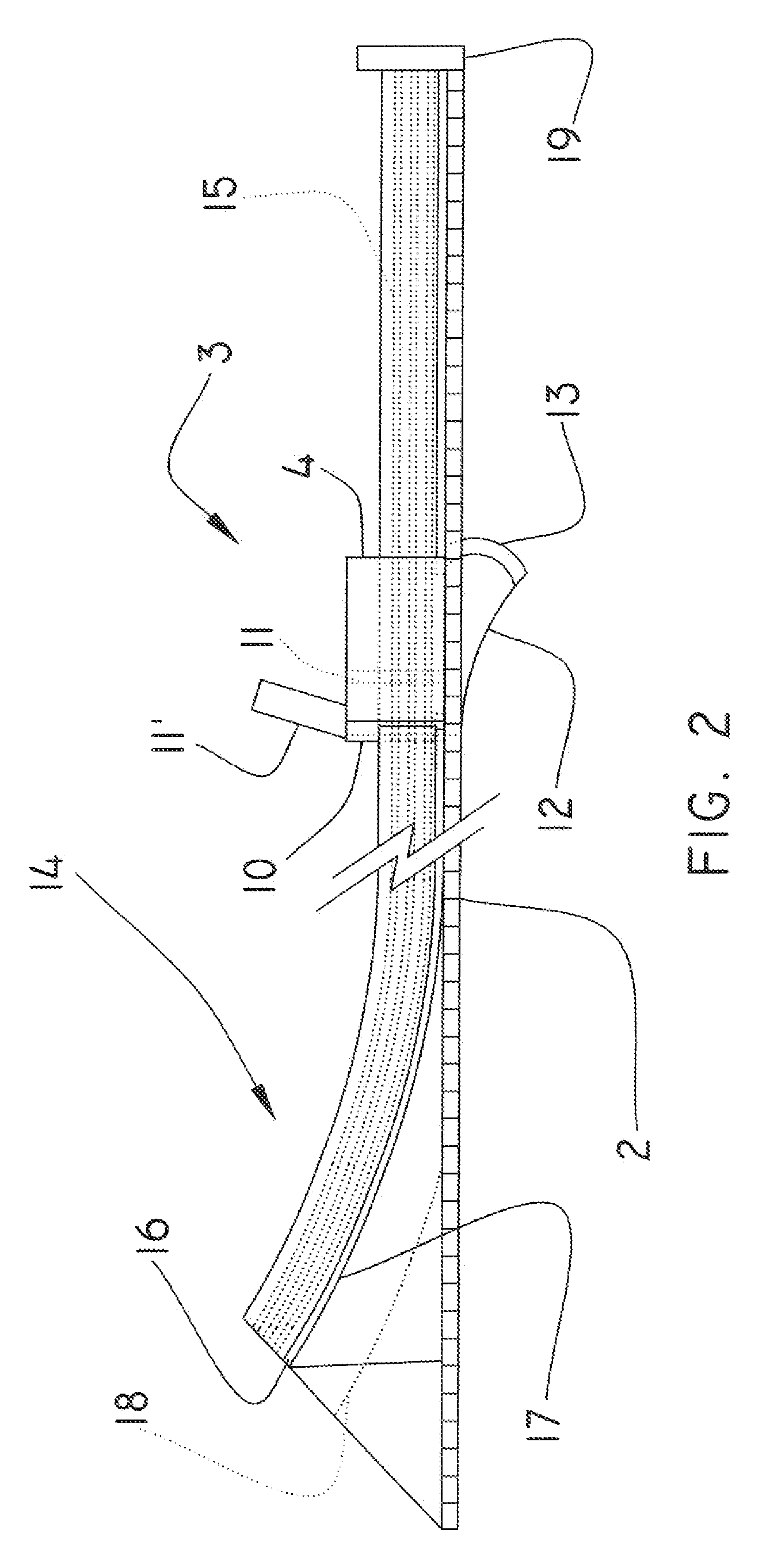 Incision and closure surgical device
