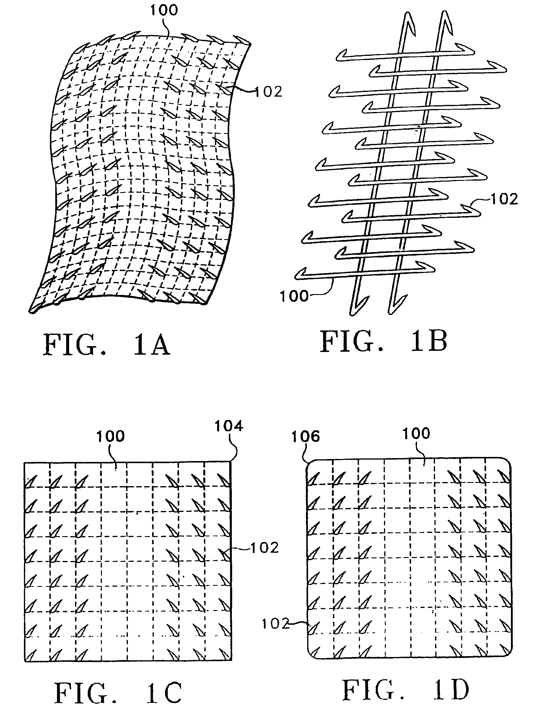Multi-point tension distribution system device and method of tissue approximation using that device to improve wound healing
