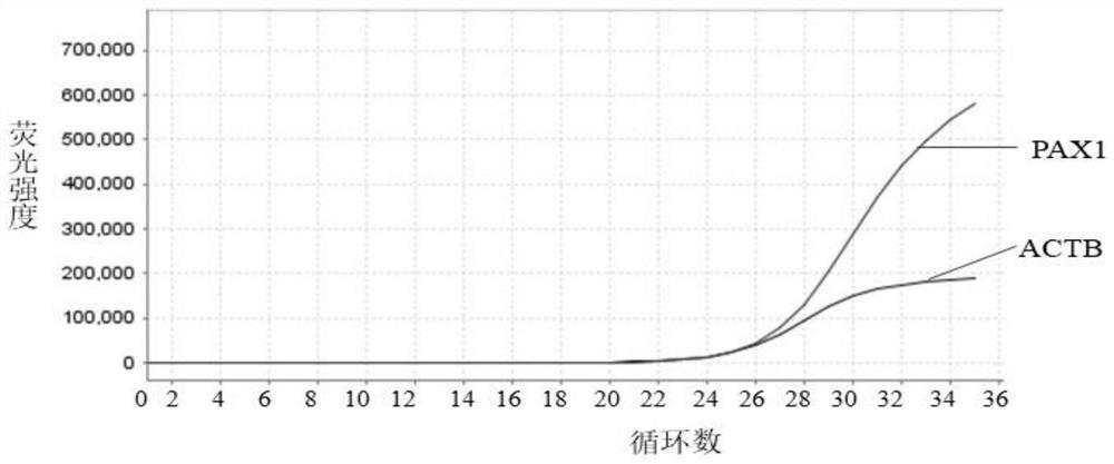 Primer probe combination for methylation detection of cervical cancer related genes and application of primer probe combination