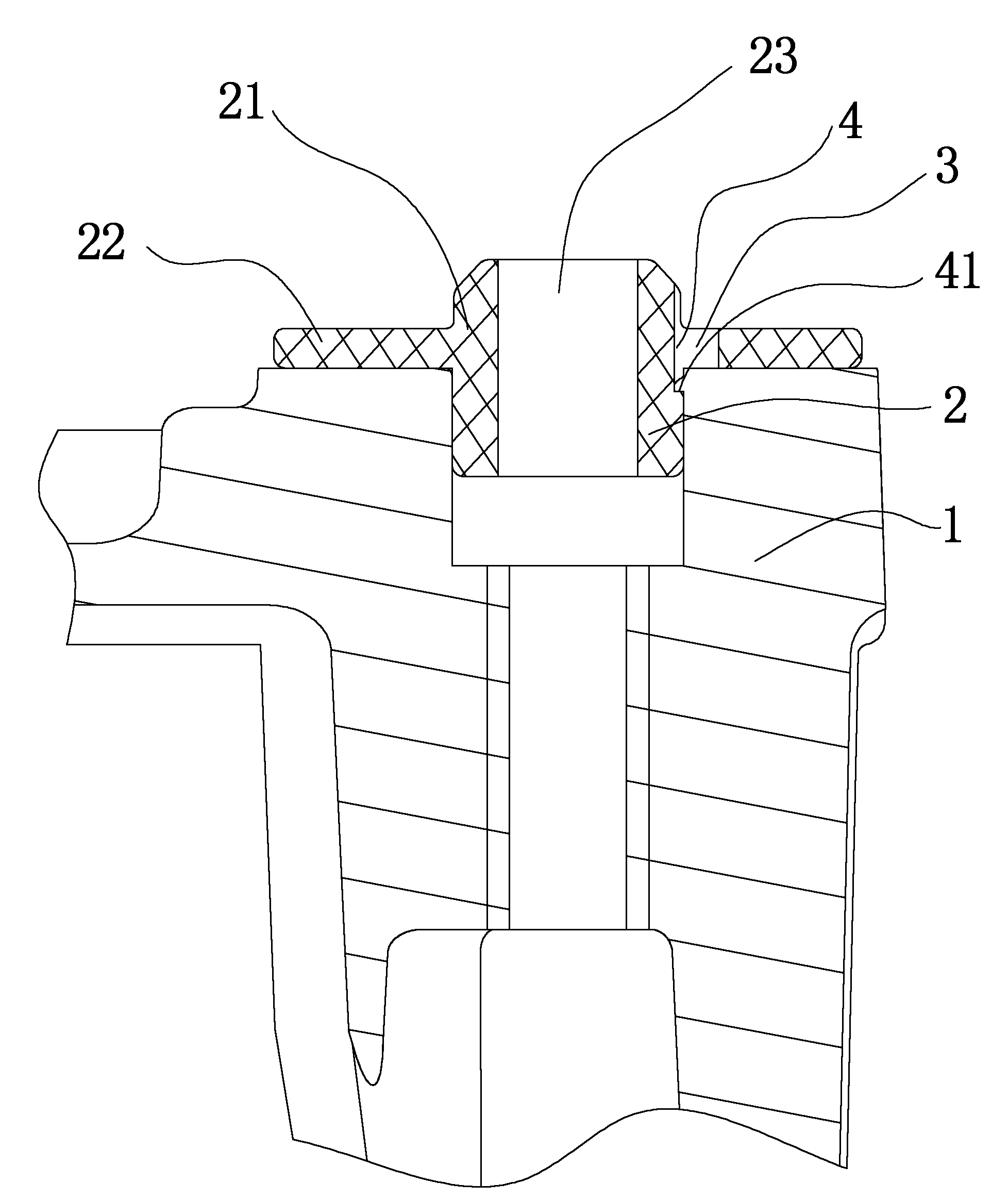 Motor fixing support and assembling method thereof