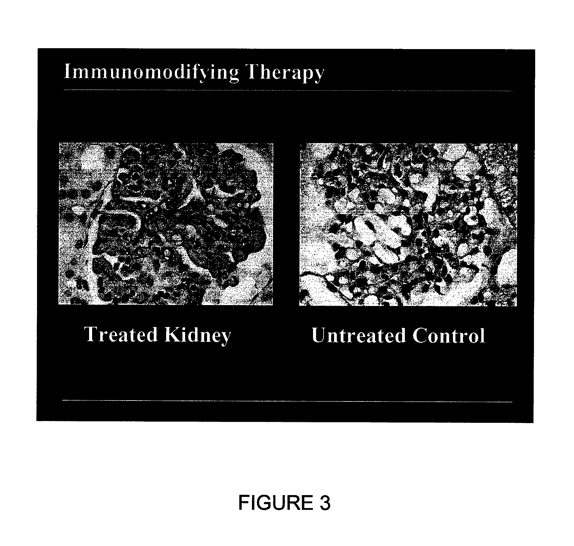 System for exsanguinous metabolic support of an organ or tissue