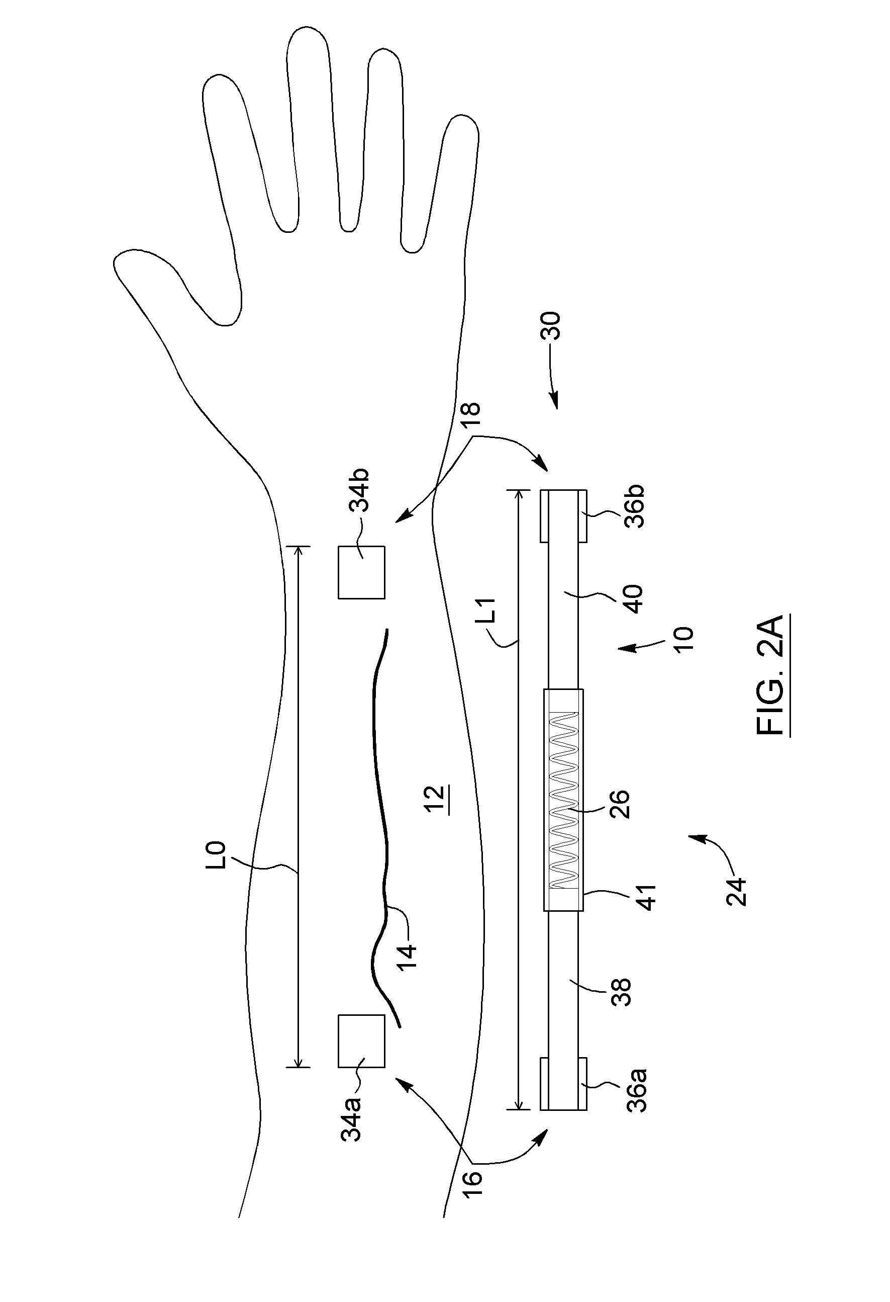 Device, use thereof and method for reducing scarring of wound