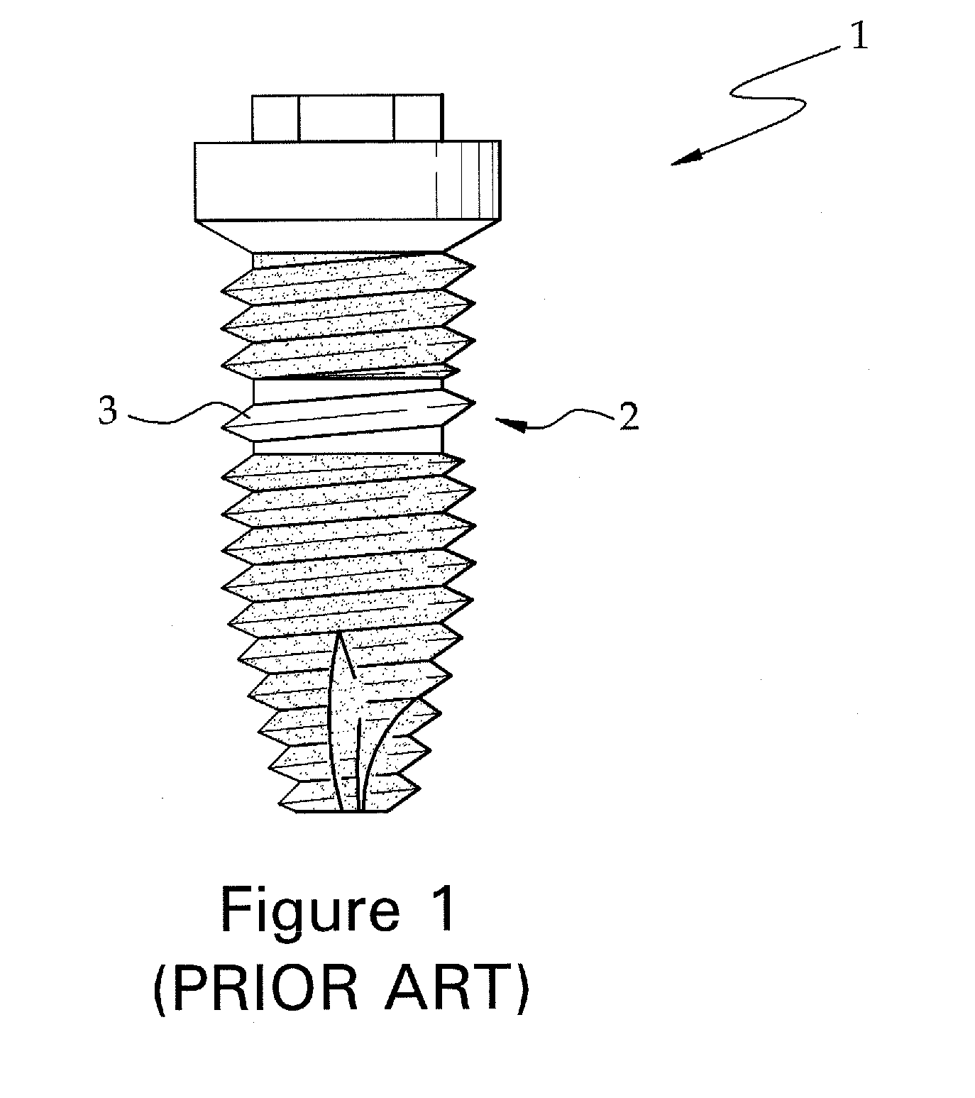 Fixture of dental implant and method of manufacturing the same