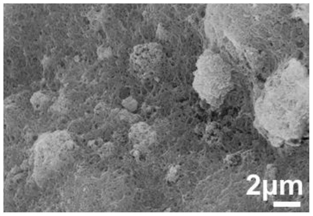 A kind of chitin nanofiber porous composite microsphere blood ammonia adsorbent, its preparation method and application