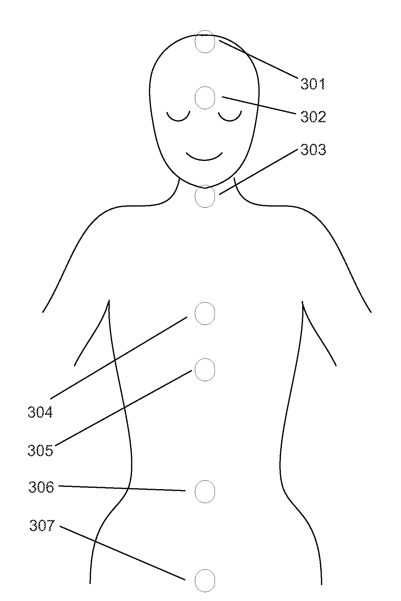 Method and apparatus for treatment of neurodegenerative diseases including depression, mild cognitive impairment, and dementia