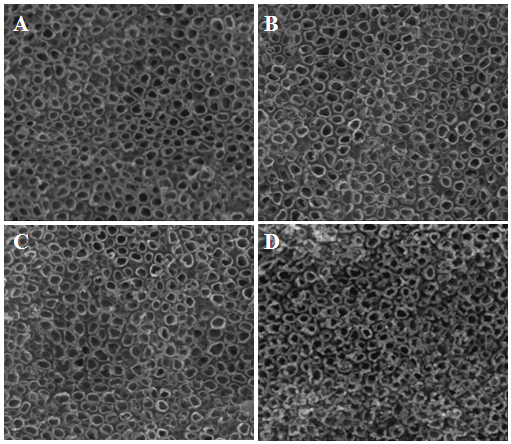 Method for preparing medical titanium material with long-acting antibacterial property and good biocompatibility