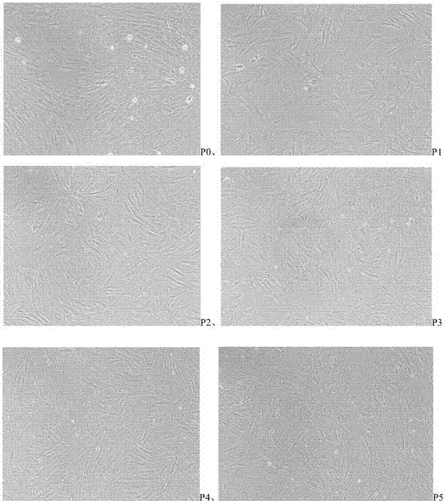 Method for obtaining a large number of adipose-derived mesenchymal stem cells from fat