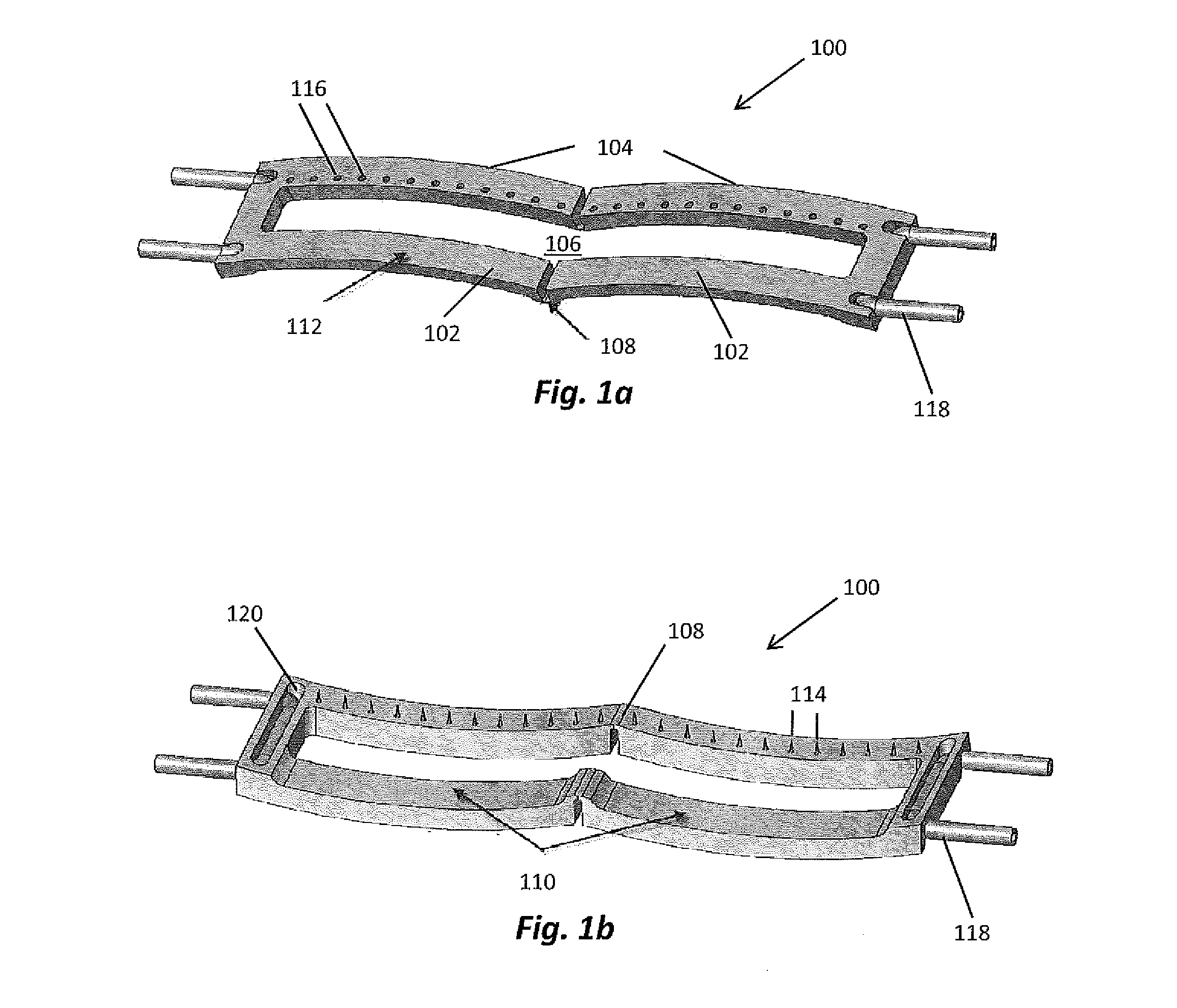 Skin Tensioning Devices and Methods of Their Use
