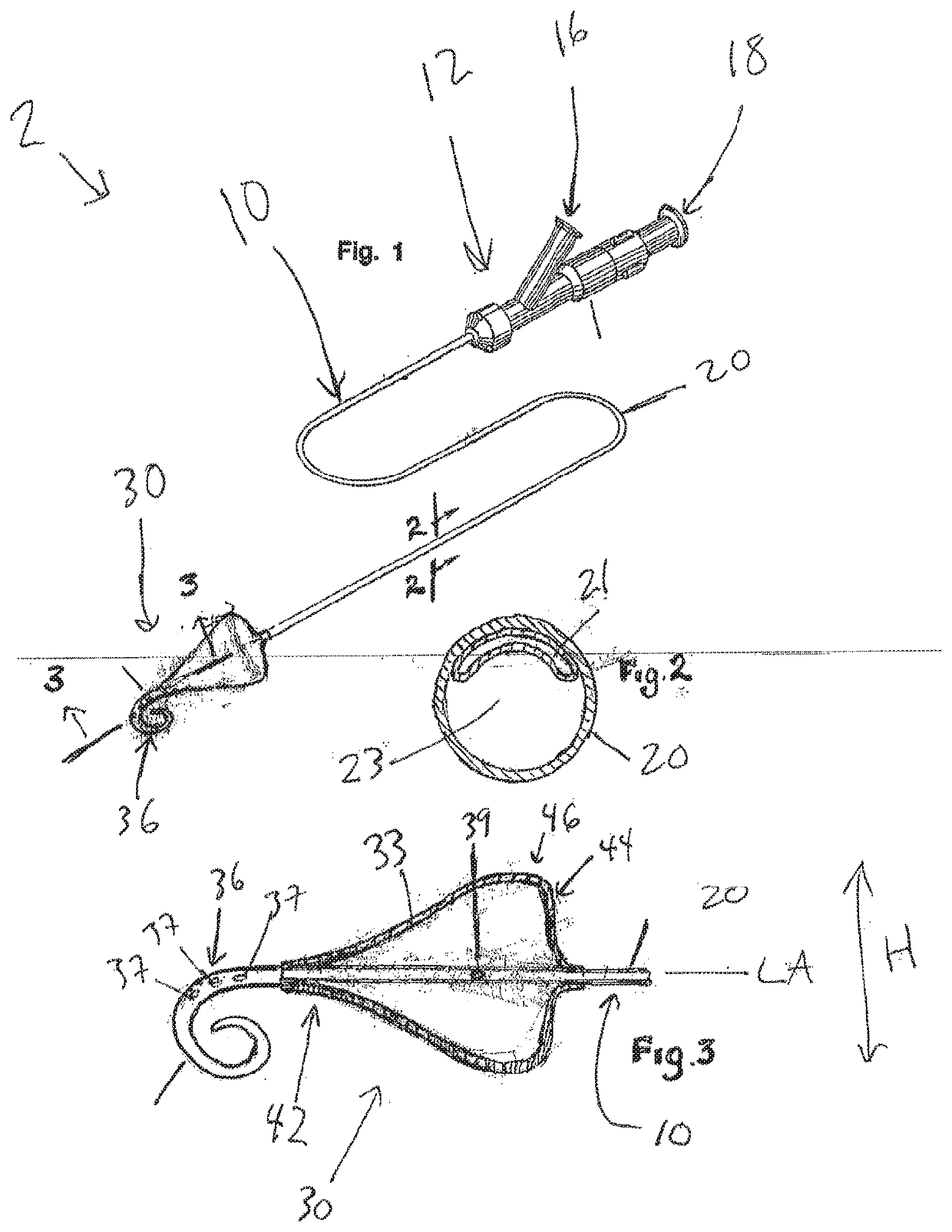 Left atrial appendage occlusion methods and devices