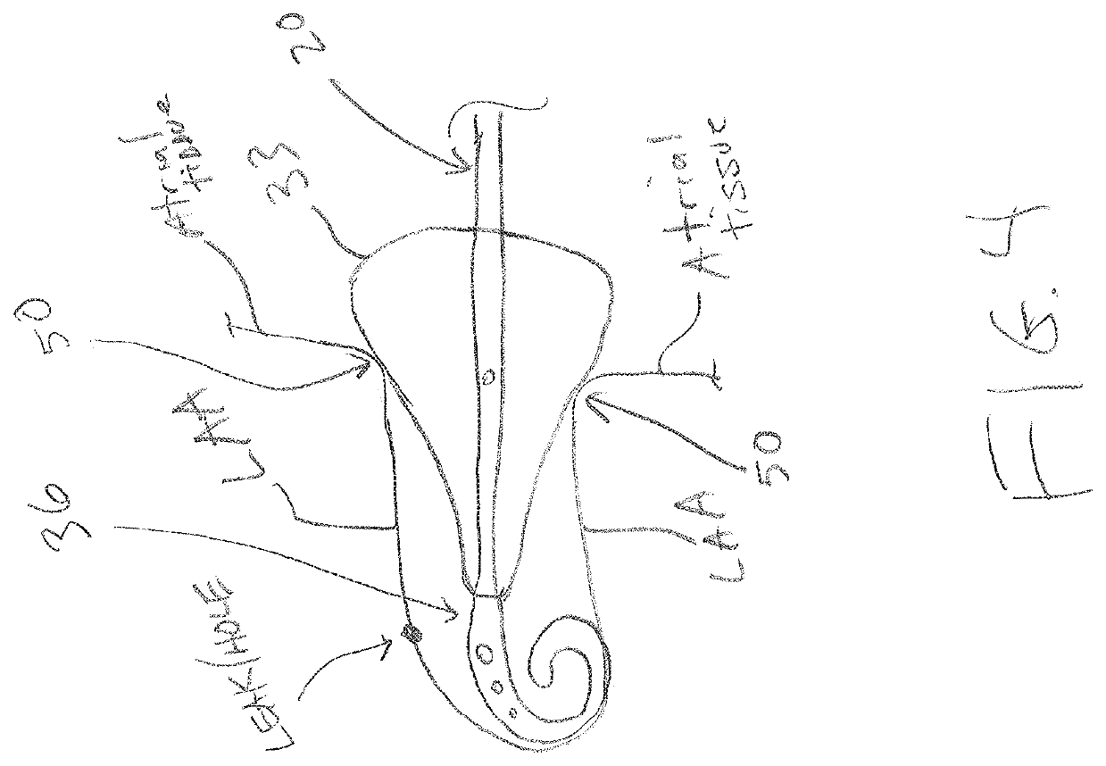 Left atrial appendage occlusion methods and devices