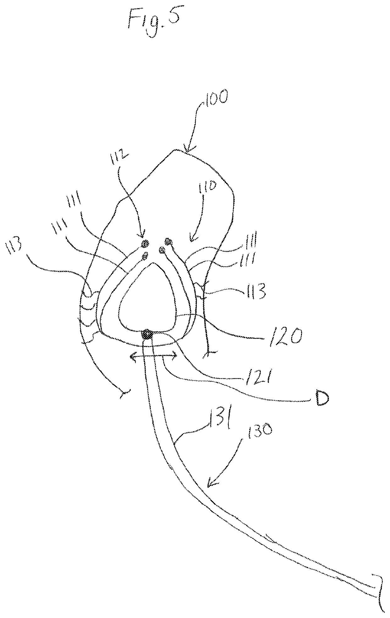 Left atrial appendage occlusion methods and devices