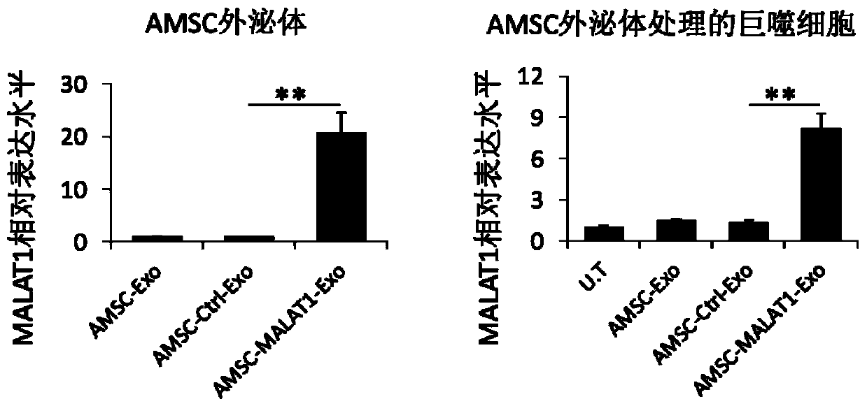 Application of AMSC-MALAT1-Exo to preparation of medicine for treating hepatic diseases and preparation method of AMSC-MALAT1-Exo