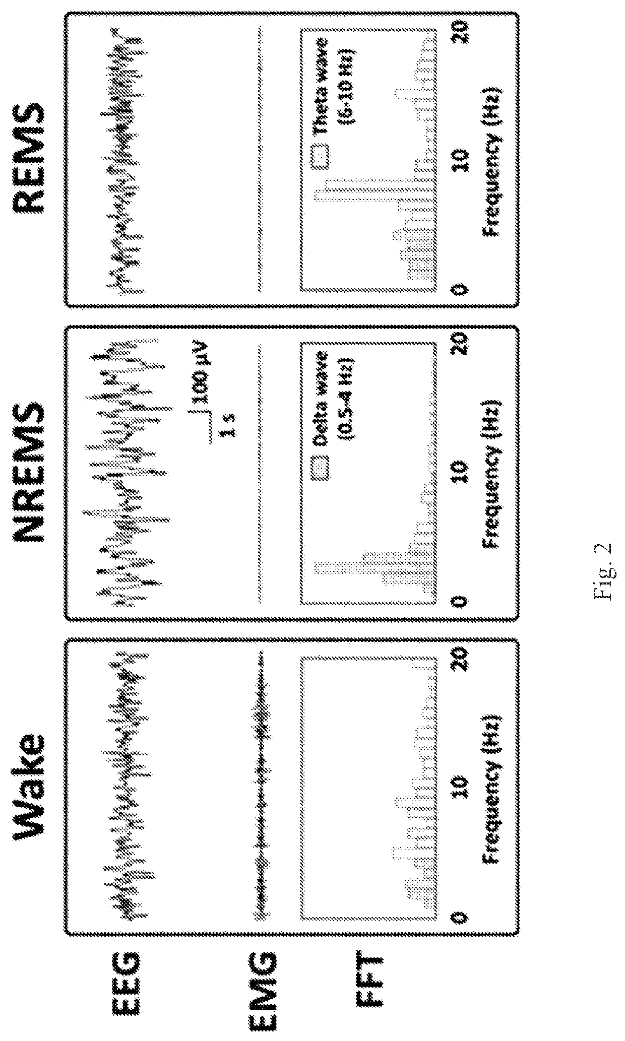 Compositions for ameliorating, preventing or treating somnipathy including phloroglucinol as active ingredient and compositions for suppressing intolerance to or alleviating side effects of agonist at benzodiazepine binding site of GABA-A receptor including phloroglucinol as active ingredient