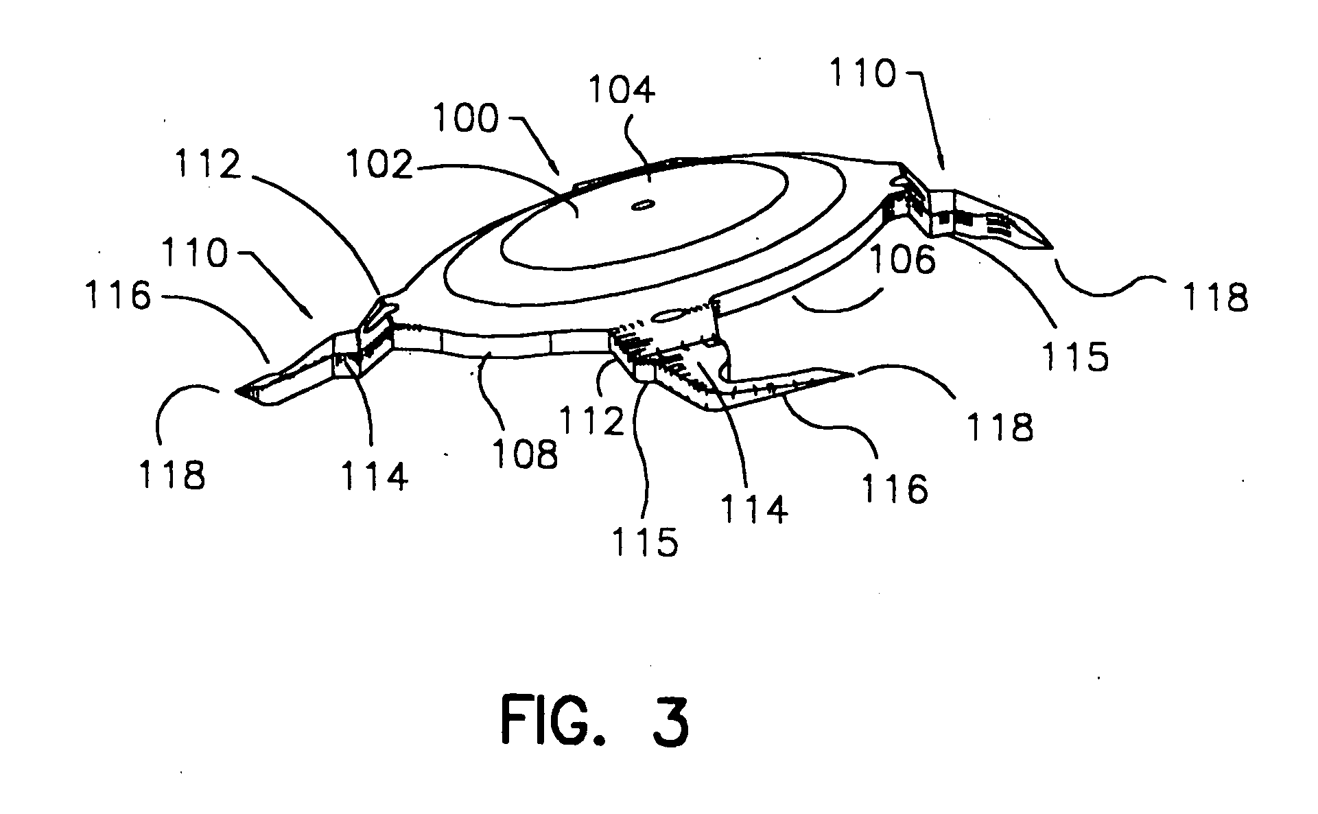 Refractive intraocular implant lens and method