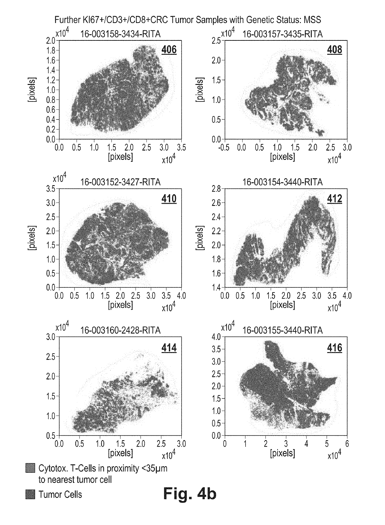 Tumor proximity measure