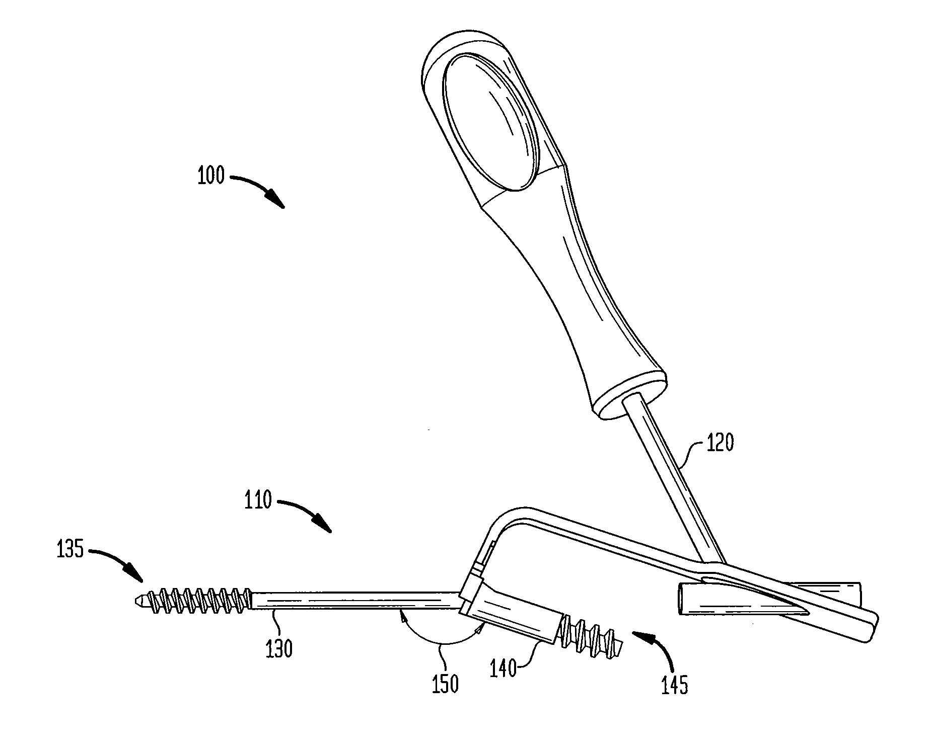 Hybrid intramedullary fixation assembly and method of use