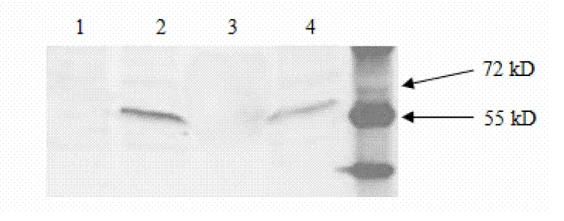 Human papillomavirus (HPV) L1-based recombinant adenovirus for preventing and treating esophagus cancer