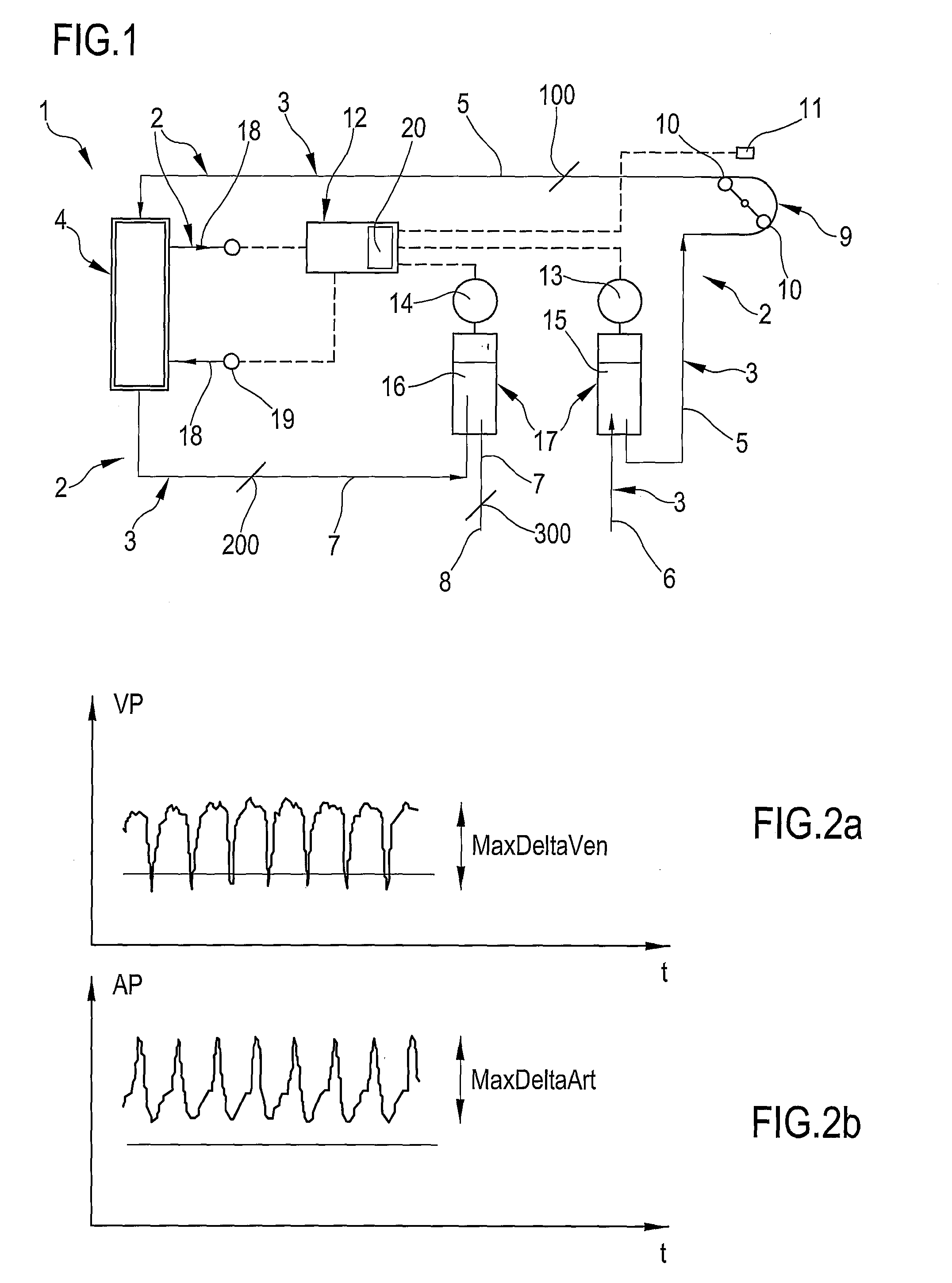 Method and a device for monitoring a state of a blood line in a machine for extracorporeal blood treatment